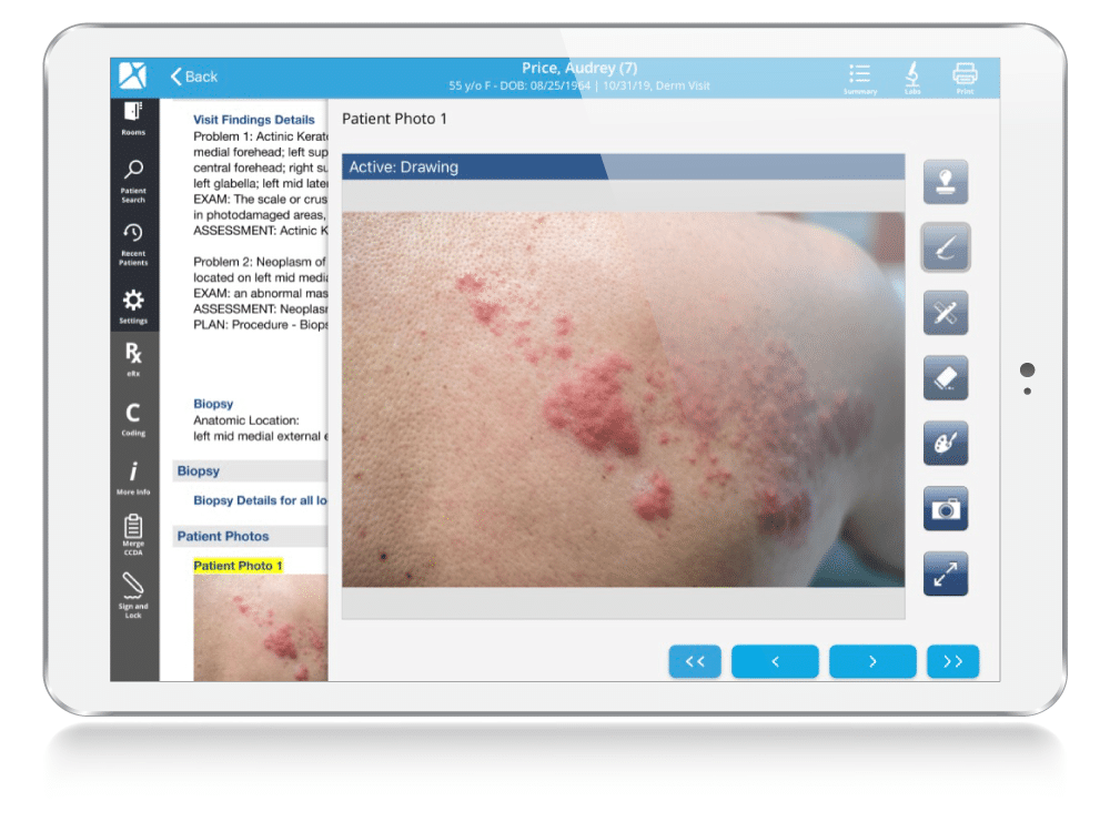 Dermatology_EHR_Photo_Management