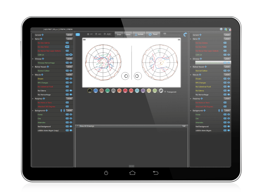 Ophthalmology EHR Layered Drawing
