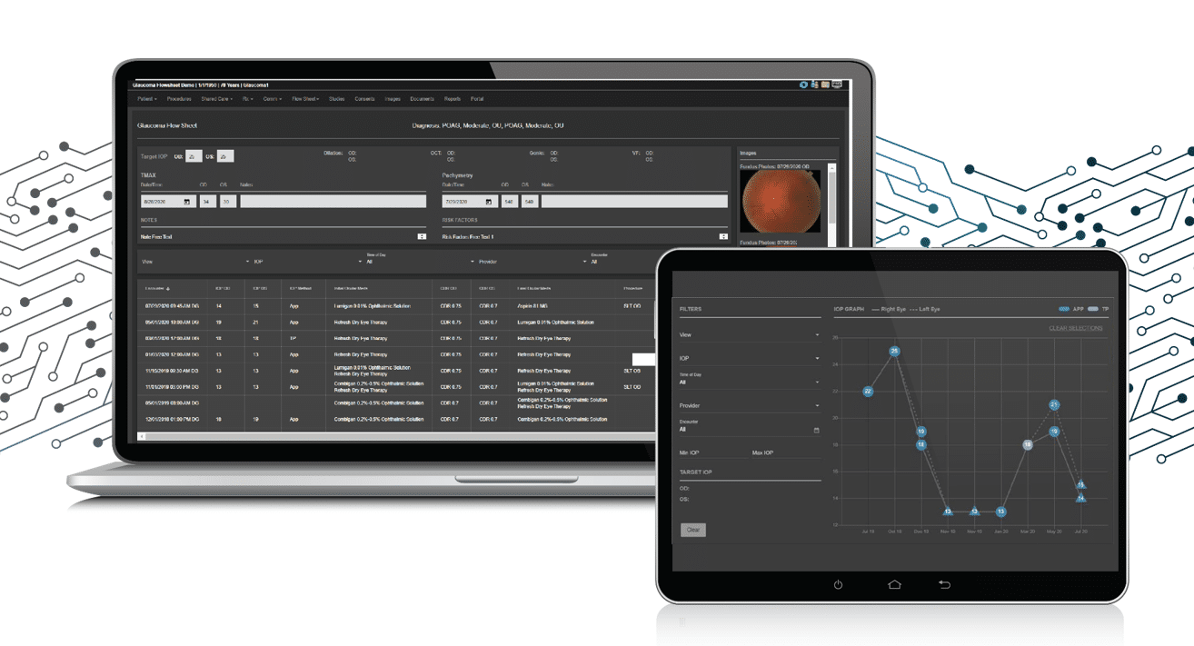 Nextech Announces New Glaucoma Flowsheet